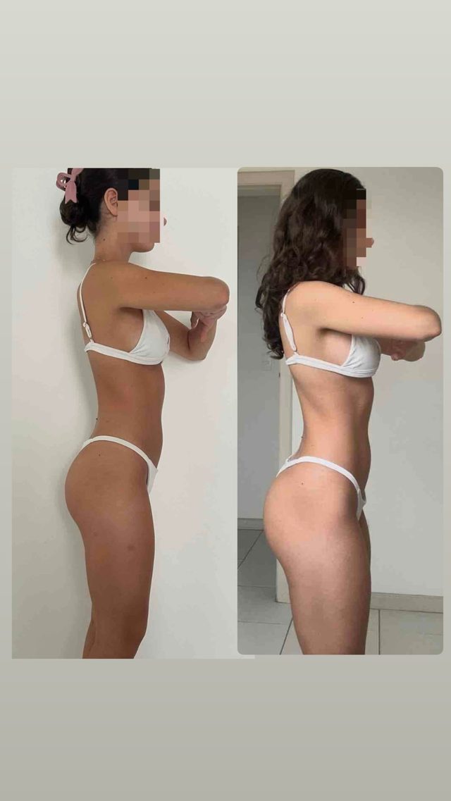 Resultado real de paciente da Chedid, foto 8 de 8