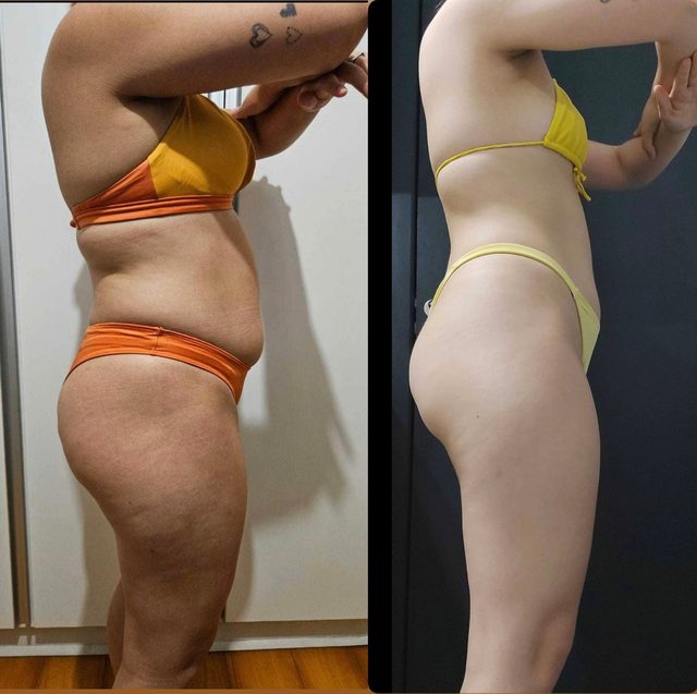 Resultado real de paciente da Chedid, foto 4 de 8