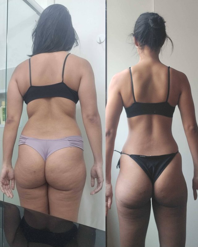 Resultado real de paciente da Chedid, foto 6 de 8